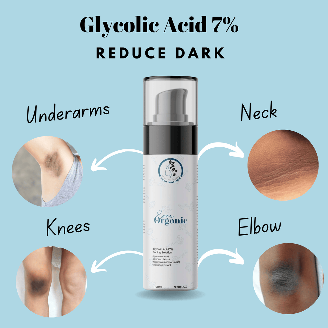 Ever Organic Exfoliating Toner with 7% Glycolic Acid – 100ml